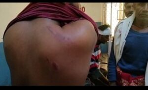 बांदा में मामूली विवाद पर चले लाठी-डंडे।