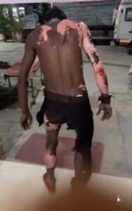 संदिग्ध परिस्थितियों में रेलवे स्टेशन पर झुलसा युवक