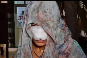 मामूली विवाद में पति का खौफनाक रूप, पत्नी का नाक-गाल चबाया।